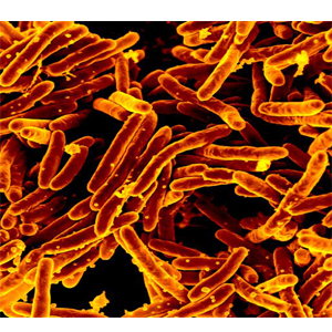 Assay for identification of pathogenic Mycobacteria